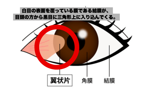 年間を通した紫外線量とリスク