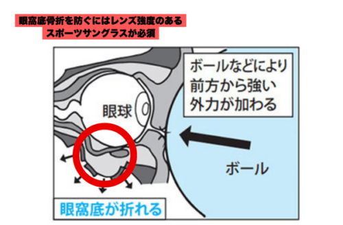 ボール直撃など外部衝撃のリスク